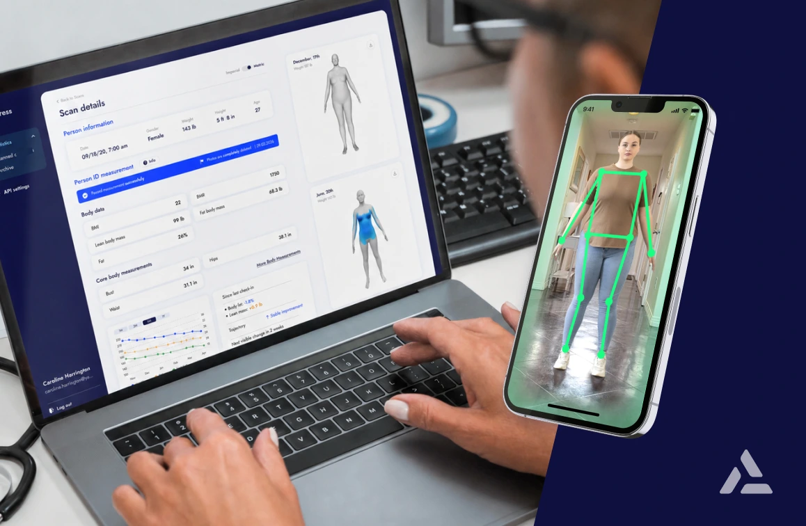A person uses a laptop showing 3D body scan data and a smartphone displaying a digital human figure with skeletal markers, illustrating Mobile 3D Body Scanning for Bariatric Pre-Qualification.